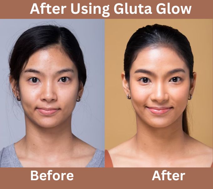Before After